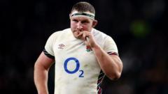 Underhill an injury doubt for Six Nations